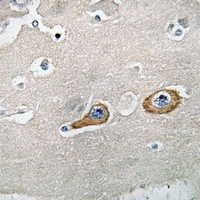 LIMK1 Rabbit Polyclonal Antibody