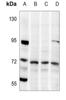 LIMK1/2 (Phospho-T508/505) Rabbit Polyclonal Antibody