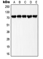 LIMK1/2 (Phospho-T508/505) Rabbit Polyclonal Antibody