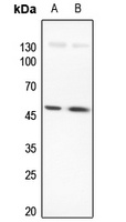 LMX1B Rabbit Polyclonal Antibody