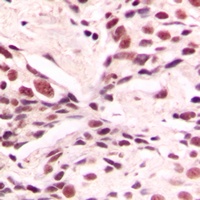 LMX1B Rabbit Polyclonal Antibody