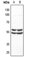 SMAD1 Rabbit Polyclonal Antibody