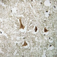 SMAD3 (Phospho-S204) Rabbit Polyclonal Antibody