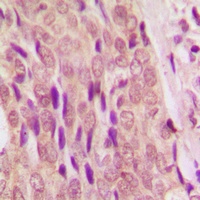 SMAD4 Rabbit Polyclonal Antibody