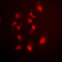 SMAD4 Rabbit Polyclonal Antibody