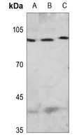MCM4 (Phospho-S54) Rabbit Polyclonal Antibody