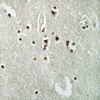 MCM4 (Phospho-S54) Rabbit Polyclonal Antibody