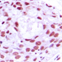 MCM4 Rabbit Polyclonal Antibody