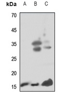 Midkine Rabbit Polyclonal Antibody