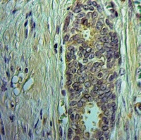 Midkine Rabbit Polyclonal Antibody