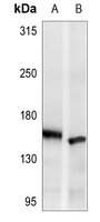 ASK1 Rabbit Polyclonal Antibody