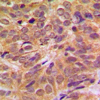 FOXO4 (Phospho-S197) Rabbit Polyclonal Antibody