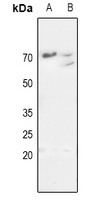 MMP11 Rabbit Polyclonal Antibody