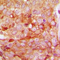 MMP11 Rabbit Polyclonal Antibody