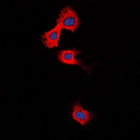 MMP11 Rabbit Polyclonal Antibody