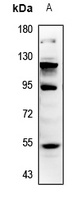 MMP12 Rabbit Polyclonal Antibody