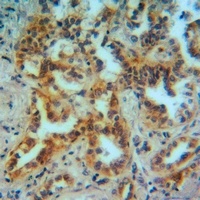 MMP12 Rabbit Polyclonal Antibody