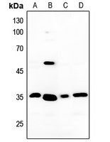 MMP13 Rabbit Polyclonal Antibody