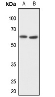 MMP14 Rabbit Polyclonal Antibody