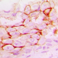 MMP14 Rabbit Polyclonal Antibody