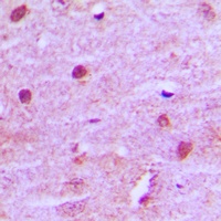 MNAT1 Rabbit Polyclonal Antibody