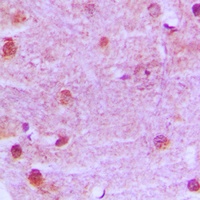 MRE11 Rabbit Polyclonal Antibody