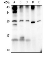 ATP6 Rabbit Polyclonal Antibody