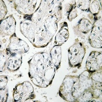 MT-ND1 Rabbit Polyclonal Antibody