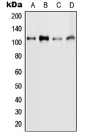 MYBL2 (Phospho-S577) Rabbit Polyclonal Antibody