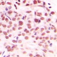 c-Myc (Phospho-S62) Rabbit Polyclonal Antibody