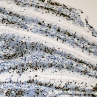 c-Myc Rabbit Polyclonal Antibody