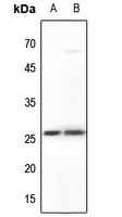 MYF5 Rabbit Polyclonal Antibody