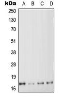 MYL6 Rabbit Polyclonal Antibody