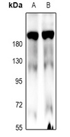 MLCK1 Rabbit Polyclonal Antibody