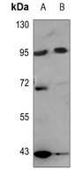 Nibrin Rabbit Polyclonal Antibody