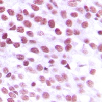 Nibrin Rabbit Polyclonal Antibody