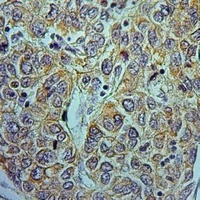 NDUFA9 Antibody