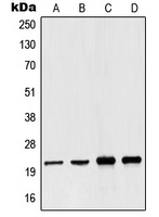 NDUFB10 Rabbit Polyclonal Antibody