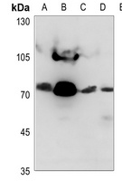 NDUFS1 Rabbit Polyclonal Antibody