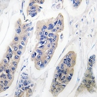 NDUFS1 Rabbit Polyclonal Antibody