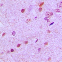 NEUROD2 Rabbit Polyclonal Antibody