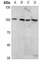 NF-kappaB p105 (Phospho-S927) Rabbit Polyclonal Antibody