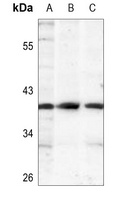 IKB alpha (Phospho-S32/S36) Antibody