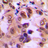 IKB alpha (Phospho-S32/S36) Antibody