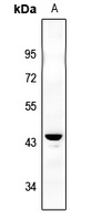 IKB beta (Phospho-S23) Rabbit Polyclonal Antibody