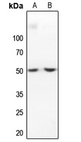 IKB beta Rabbit Polyclonal Antibody