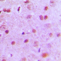 NFYA Rabbit Polyclonal Antibody