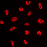 NFYA Rabbit Polyclonal Antibody