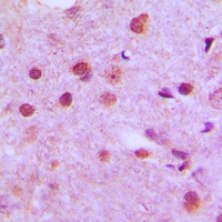 NFYC Rabbit Polyclonal Antibody