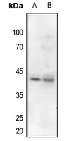 Nucleophosmin (Phospho-T199) Rabbit Polyclonal Antibody